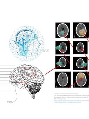 Brain-image-genetics