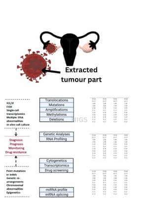  Diagnosis-of-Ovarian-Tumor